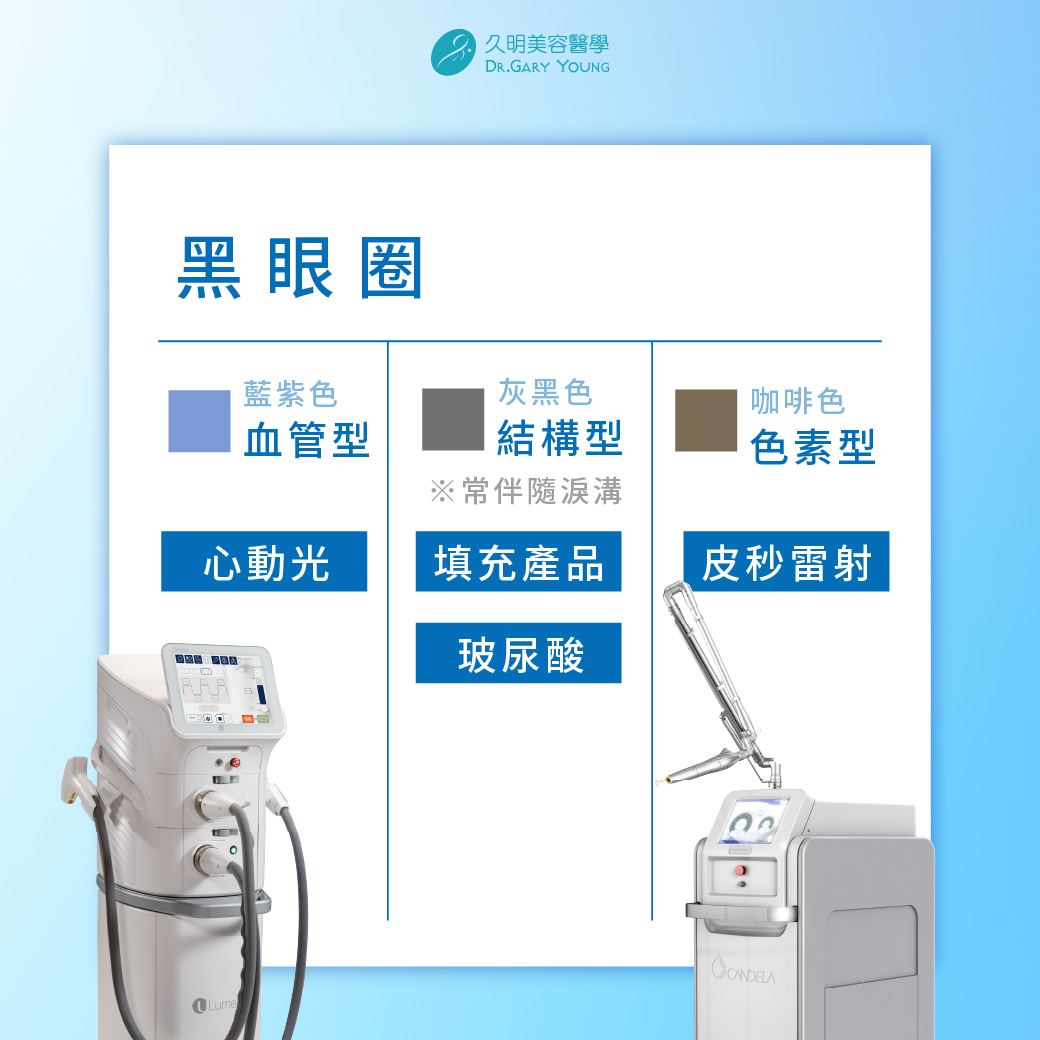血管型黑眼圈