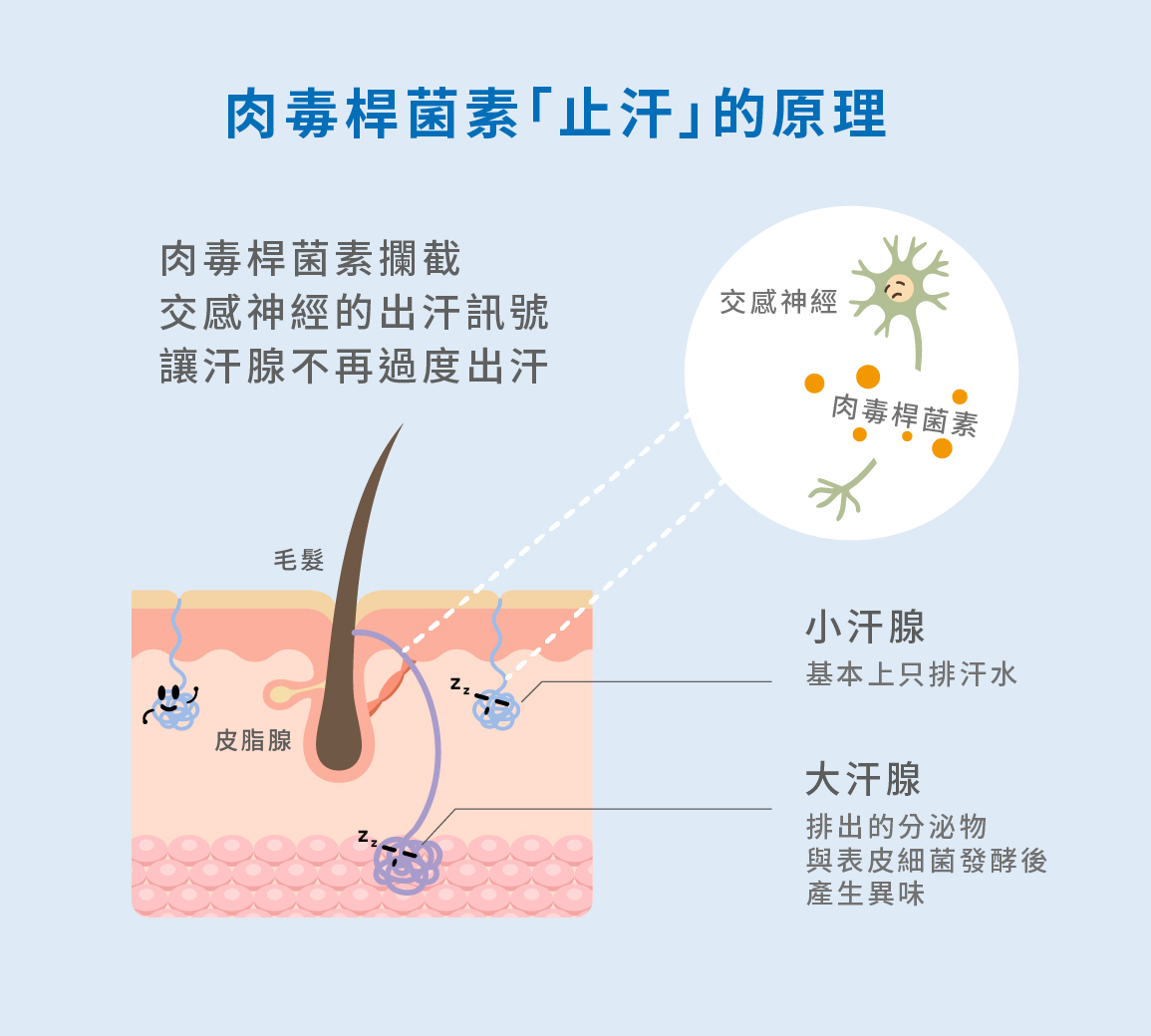 肉毒止汗有副作用嗎？
