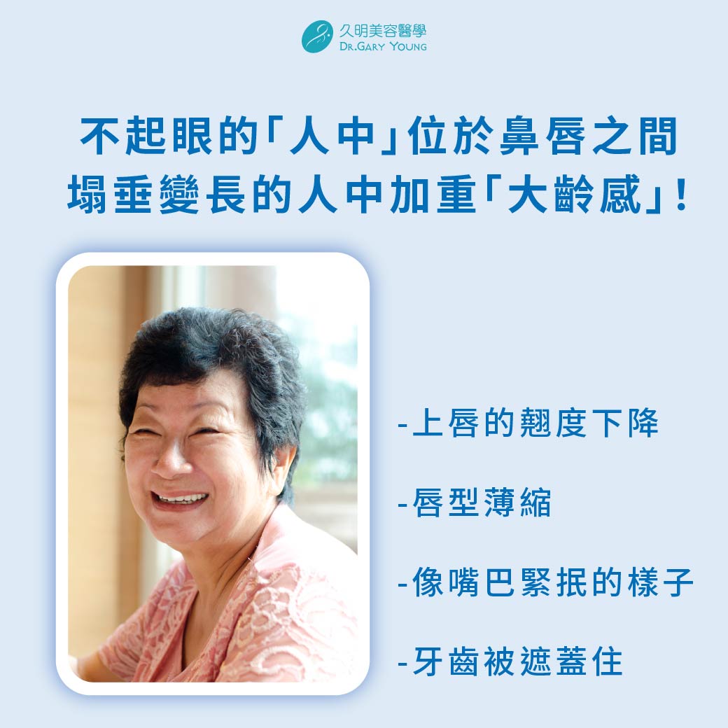 為什麼人中變長，老齡感也加重？