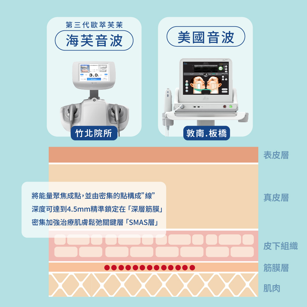 免開刀筋膜下拉皮！就選「超4D動態複合除皺拉提」－複合式音波