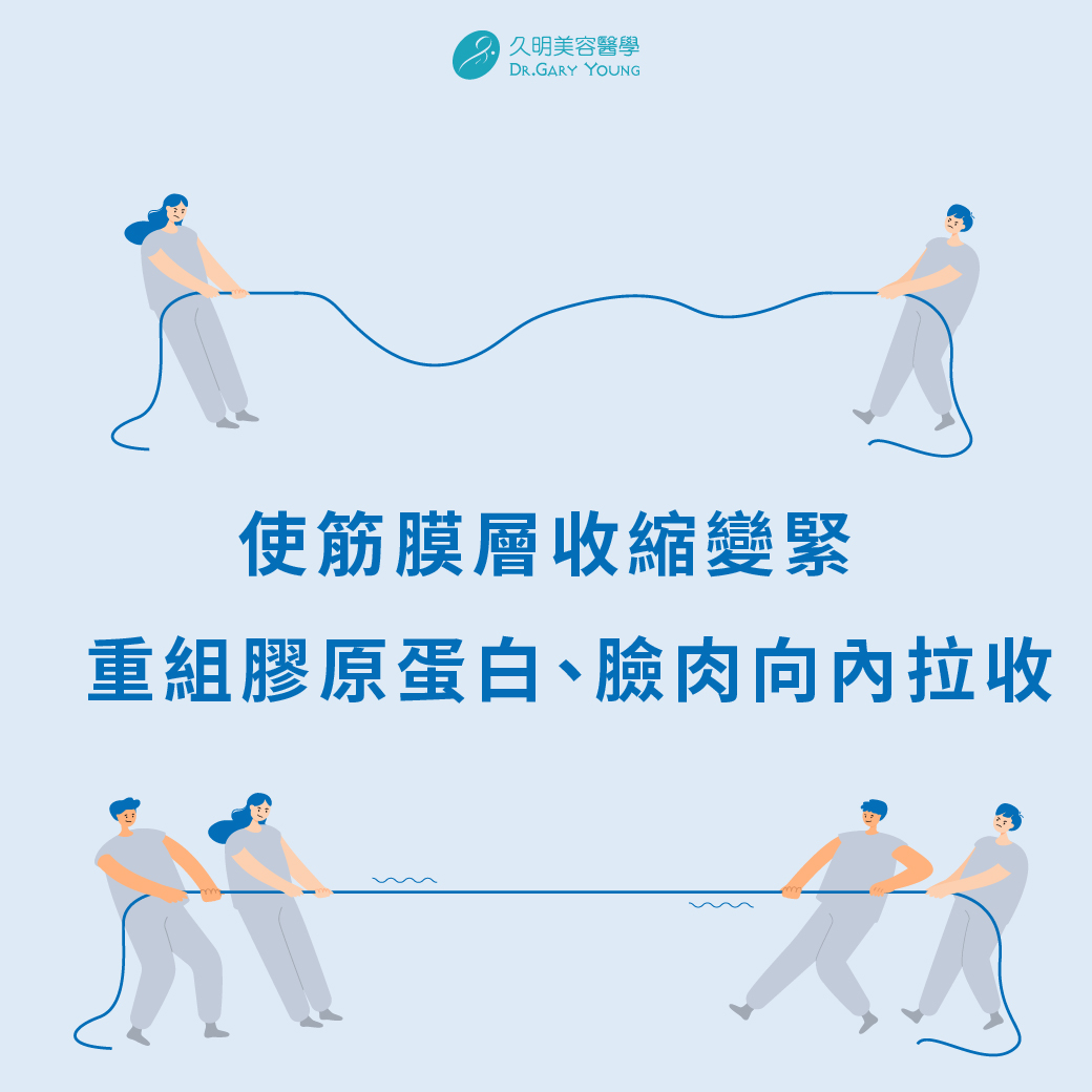 音波打久了筋膜會脆化？