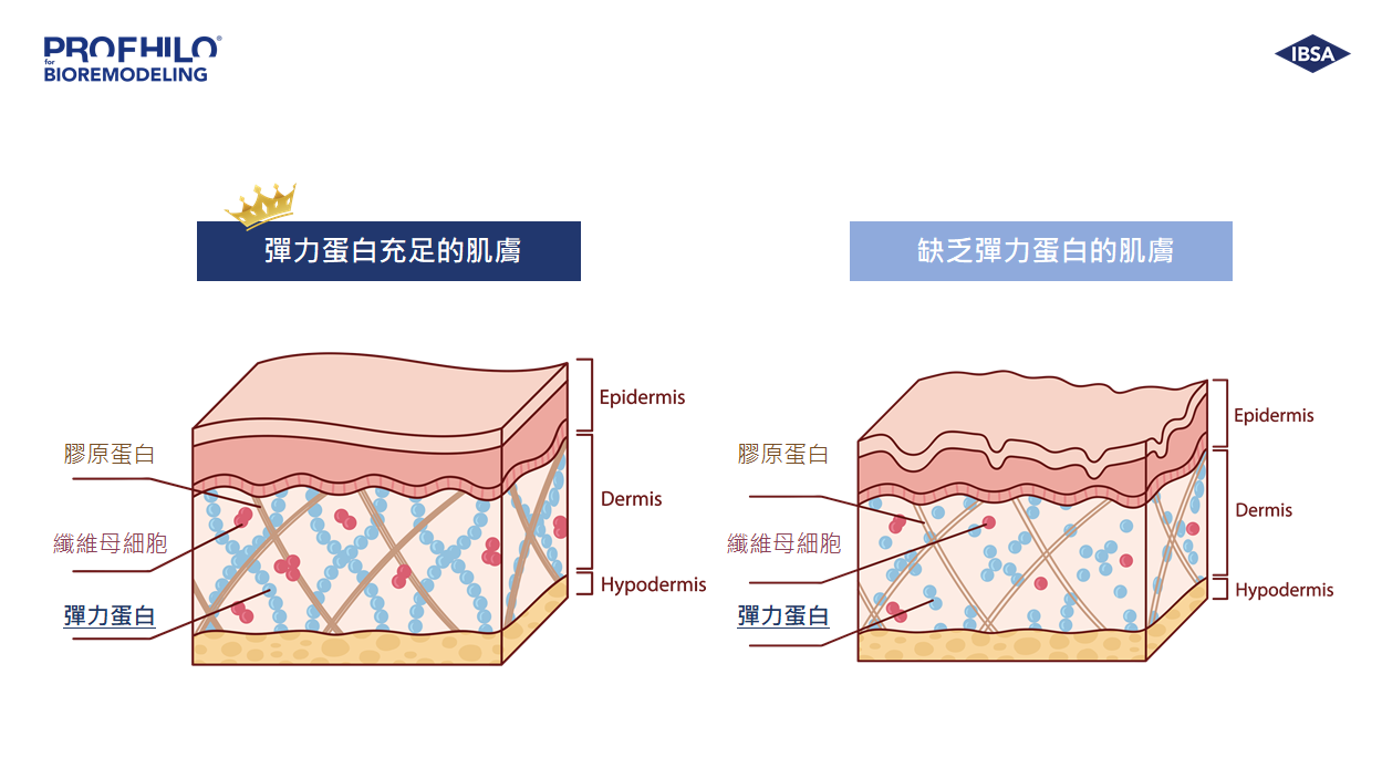 「逆時真 PROFHILO 」與「水光注射」一樣嗎？